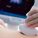 sonography Pretoria